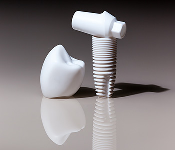 Health Benefits of Dental Implants Explained by Greenville Dentist